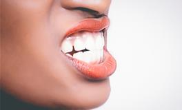 梦到牙上有东西