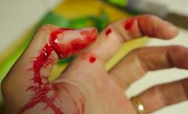 梦见自己的大腿流血